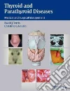 Thyroid and Parathyroid Diseases Thyroid and Parathyroid Diseases